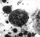 для какой группы организмов типична мутация полиплоидии. Смотреть фото для какой группы организмов типична мутация полиплоидии. Смотреть картинку для какой группы организмов типична мутация полиплоидии. Картинка про для какой группы организмов типична мутация полиплоидии. Фото для какой группы организмов типична мутация полиплоидии