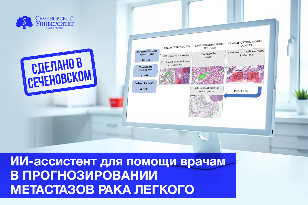  В Сеченовском Университете создали ИИ для помощи врачам в прогнозировании метастазов рака легкого 