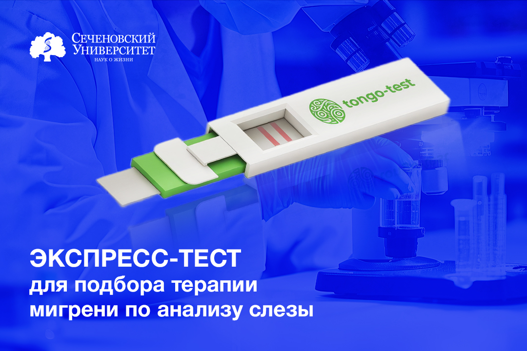  В Сеченовском Университете разрабатывают экспресс-тест для подбора терапии мигрени по анализу слезы 