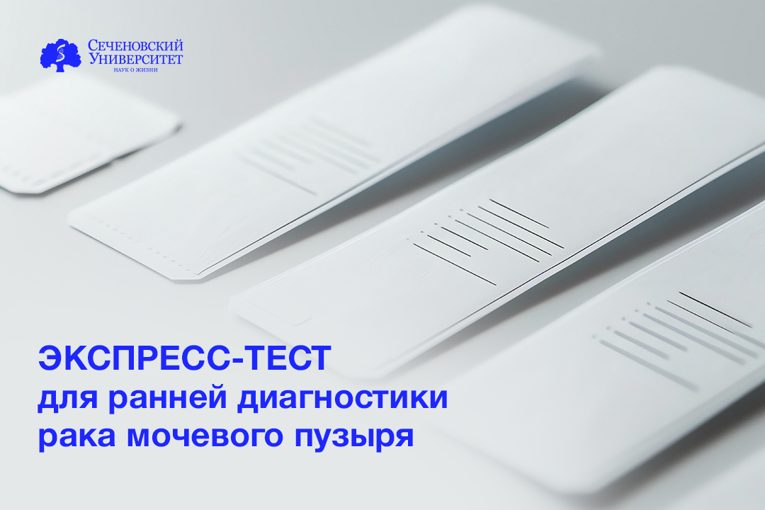  В Сеченовском Университете разрабатывают экспресс-тест для ранней диагностики рака мочевого пузыря 