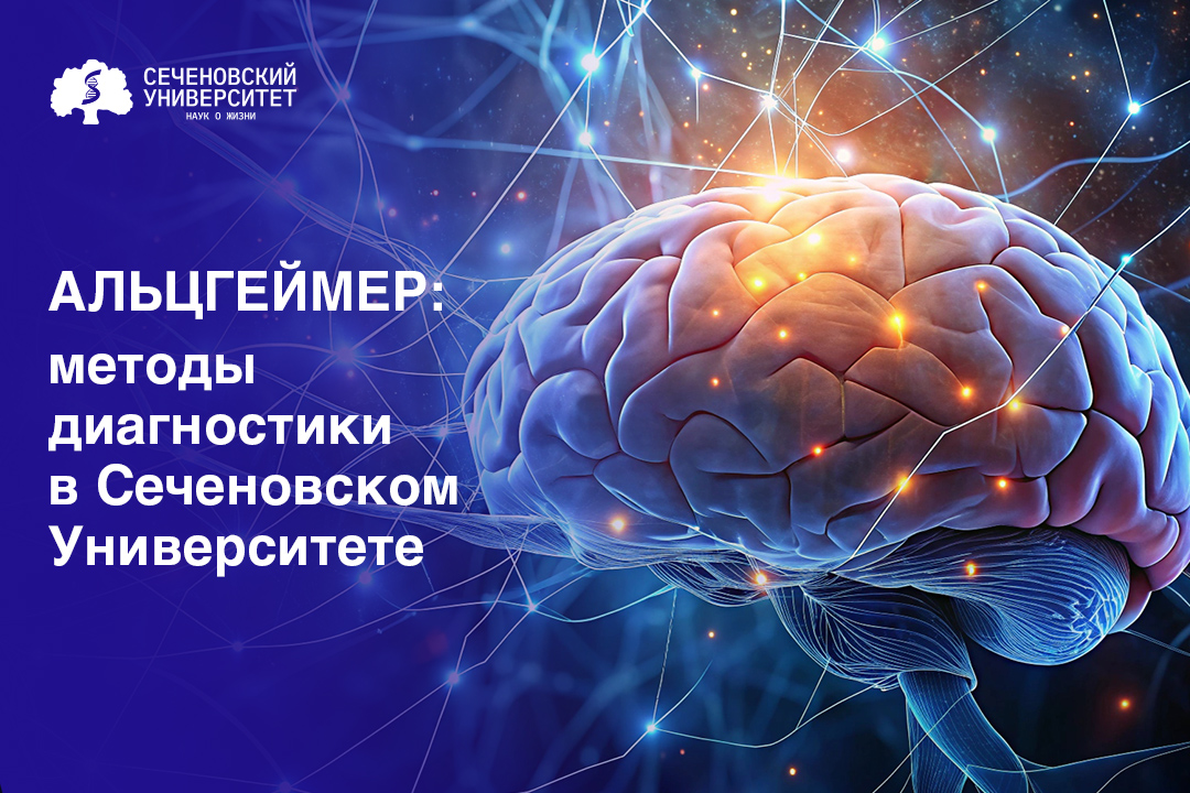 В Сеченовском Университете для диагностики болезни Альцгеймера применяют анализ биомаркеров в цереброспинальной жидкости