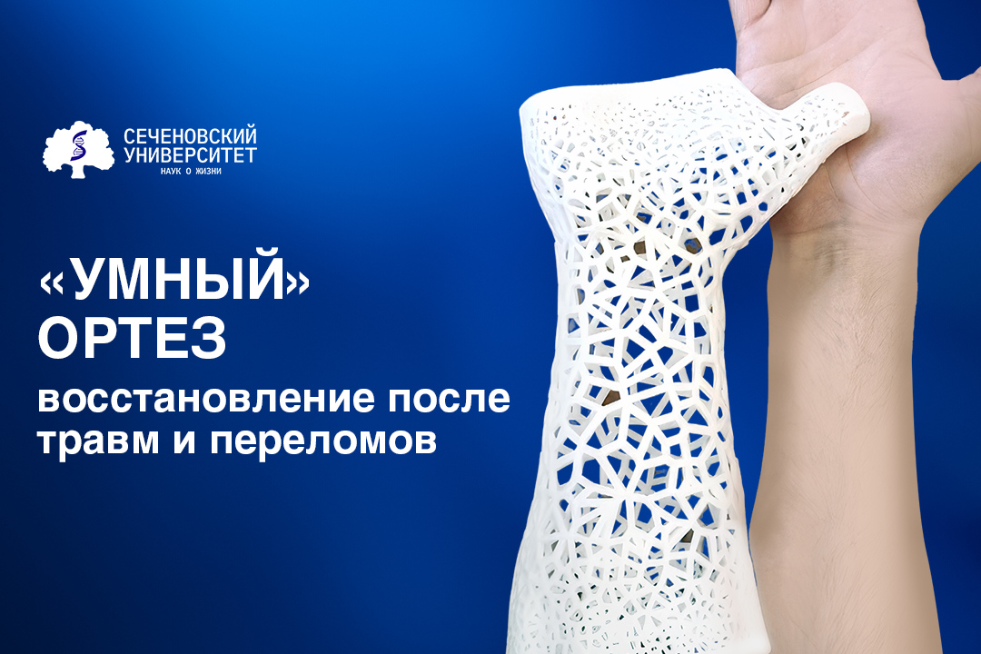 В Сеченовском Университете разработали «умный» ортез с программируемыми свойствами жесткости для восстановления после травм и переломов