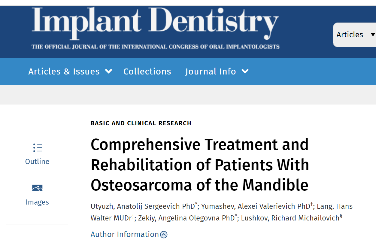 Публикация в ведущем международном журнале по имплантологии