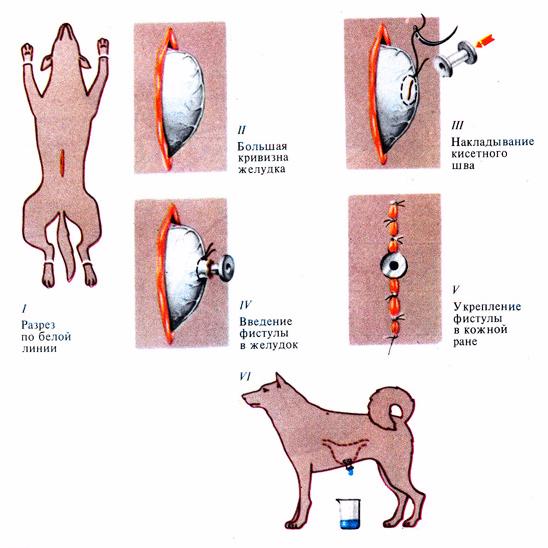 WORLD’S FIRST GASTROSTOMY. Basov’s Fistula