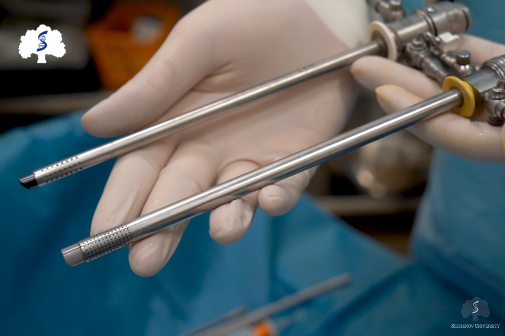 Sechenov University urologists present MILES study results at London congress