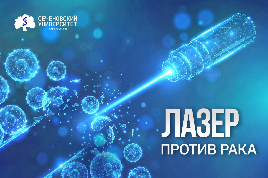 Лазер против рака: в Сеченовском Университете испытали фотодинамическую терапию для уничтожения опухолевых клеток