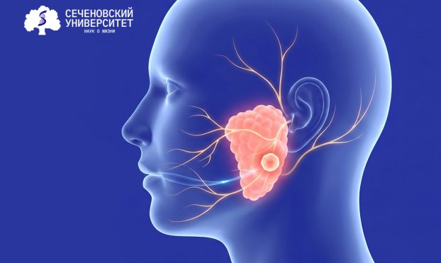 В Сеченовском Университете разрабатывают тест для диагностики опухолей околоушной слюнной железы  