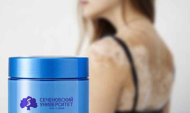  В Сеченовском Университете создали крем от витилиго 