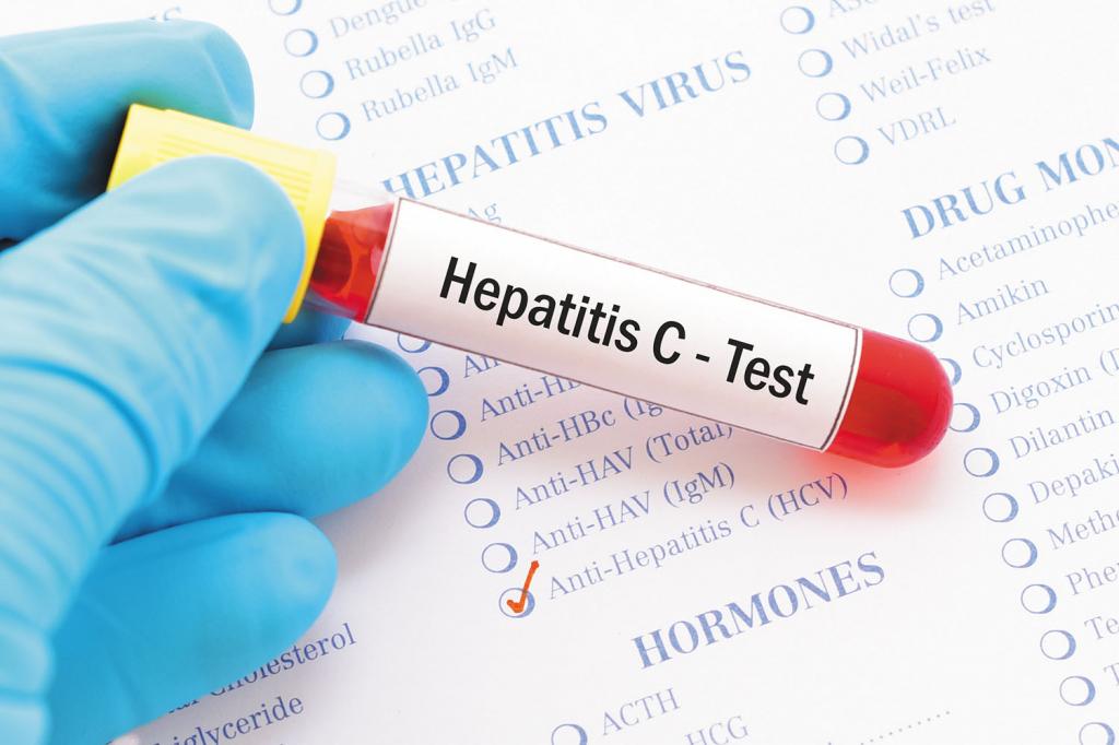 Вирусный гепатит: симптомы, диагностика и лечение
