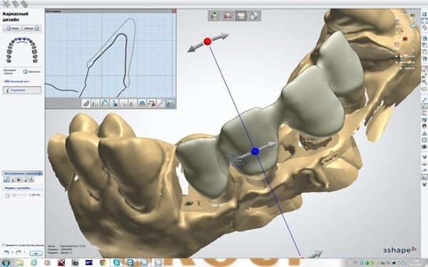 3 ortopedicheskaya o obshchaya stomatologiya cad cam1