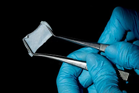 Российские ученые разработали способ производства стоматологических мембран без дефектов