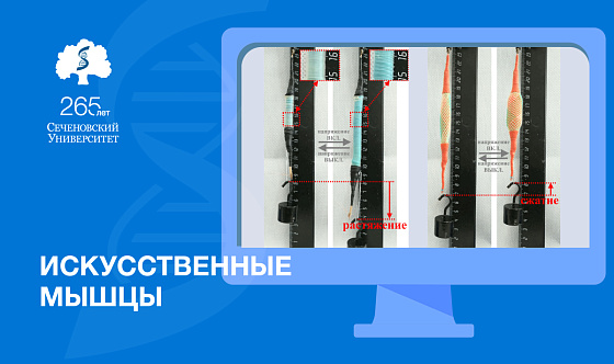 В Сеченовском Университете разработали «искусственные мышцы», работающие от переменного тока