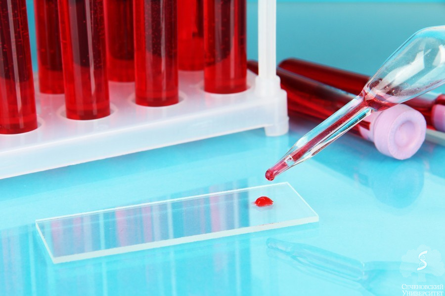 New Method Can Detect Cancer in a Drop of Blood New Method Can Detect Cancer in a Drop of Blood