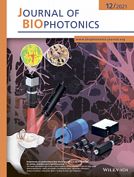 В центре внимания. Иллюстрация  статьи ученых Сеченовского Университета на обложке Journal of Biophotonics 