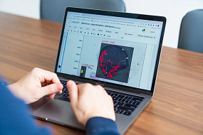 В Сеченовском Университете обучают искусственный интеллект определять метастазы при колоректальном раке на гистосканах