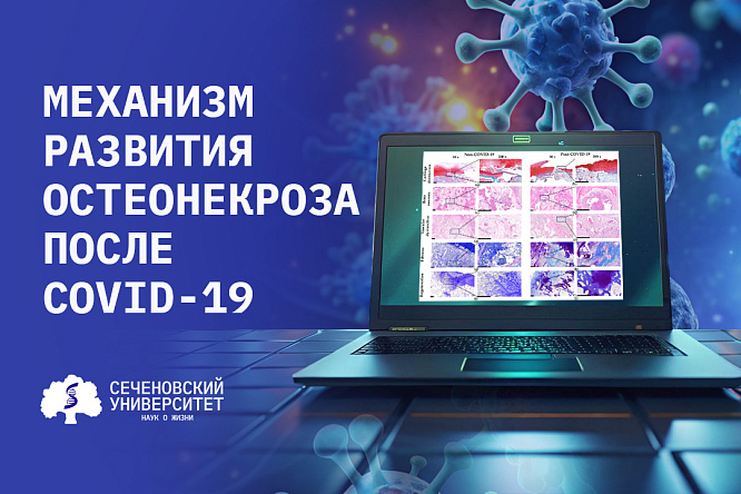 Ученые Сеченовского Университета выявили особый механизм развития остеонекроза после COVID-19