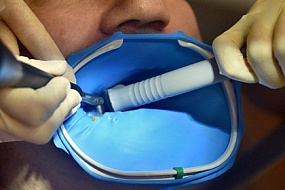 Российский врач рассказала о риске рака из-за зубов мудрости и зубных протезов