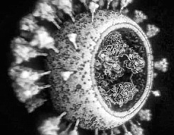 Вирусолог сравнил возможности лечить коронавирус и ВИЧ