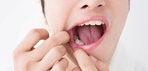  Ирина Макеева: «Стресс на фоне COVID-19 может привести к заболеваниям полости рта» 