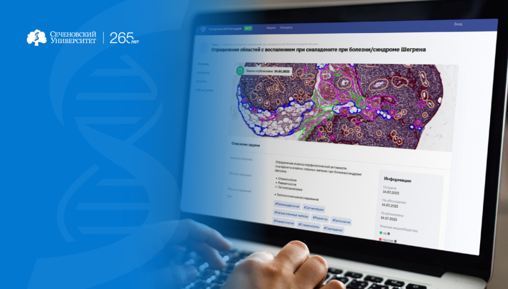  Вклад в дело цифровизации: Сеченовский Университет создал и выложил на платформу Минздрава для обучения искусственного интеллекта свой первый датасет 