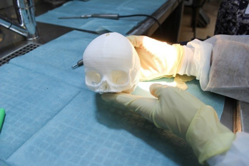 Специалисты Федерального центра нейрохирургии в Тюмени и инженеры Республики Татарстан приступили к первому этапу по созданию оперирующего робота в нейрохирургии