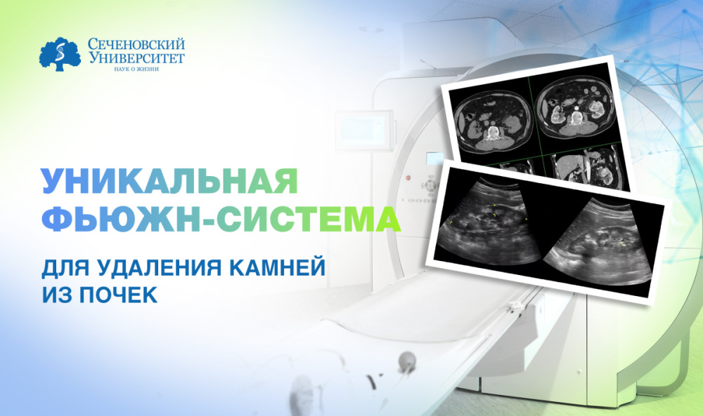  Урологи Сеченовского Университета применяют уникальную систему для удаления камней из почек 