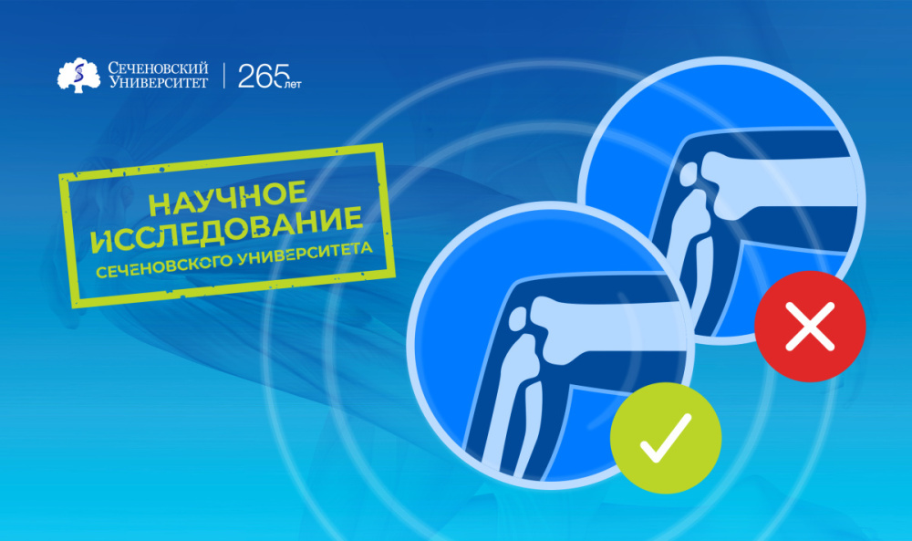 Ученые Сеченовского Университета определили, какие имплантаты лучше всего приживаются в организме