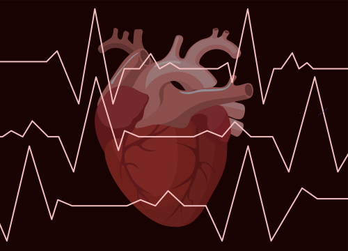 Новый курс: Впервые выявленные нарушения сердечного ритма