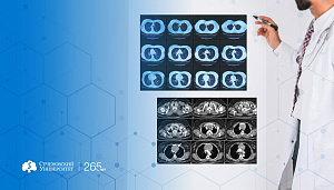  Российские ученые создадут ПО для планирования операций на органах грудной клетки 