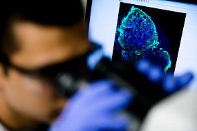 Систему выявления рака простаты с помощью искусственного интеллекта создадут в Сеченовском университете