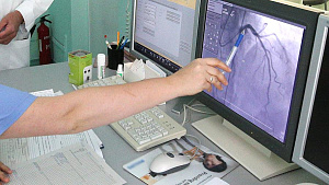 Ученые Сеченовского университета разработали программу для оценки состояния артерий