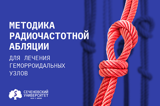 В Сеченовском Университете впервые в России применили новый максимально щадящий метод лечения геморроидальных узлов