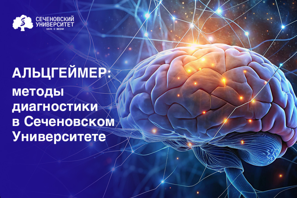 В Сеченовском Университете для диагностики болезни Альцгеймера применяют анализ биомаркеров в цереброспинальной жидкости